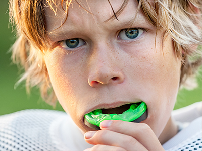 Lutz Dental | Sports Mouthguards, All-on-4 reg and Veneers